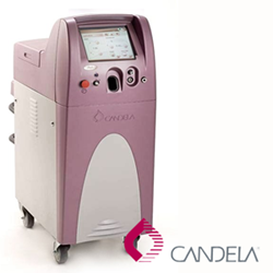 33618-candela-beam.png